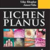 Lichen Planus