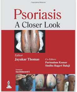 Psoriasis: A Closer Look 1st Edition