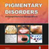 Pigmentary Disorders: A Comprehensive Compendium