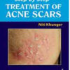 Step by Step® Treatment of Acne Scars