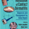 Clinical Handbook of Contact Dermatitis: Diagnosis and Management by Body Region