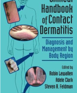 Clinical Handbook of Contact Dermatitis: Diagnosis and Management by Body Region