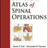 Surgical Atlas of Spinal Operations