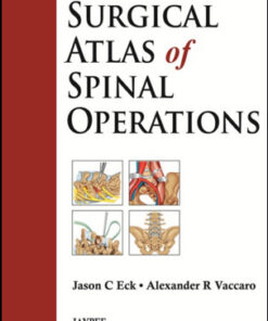 Surgical Atlas of Spinal Operations