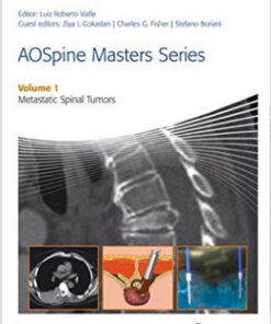 AOSpine Masters Series Volume 1: Metastatic Spinal Tumors (Aospine Master Series) 1st Edition