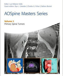 AOSpine Masters Series Volume 2: Primary Spinal Tumors 1st Edition