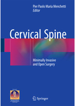 Cervical Spine :Minimally Invasive and Open Surgery