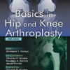 Basics in Hip and Knee Arthroplasty