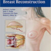 Perforator Flaps for Breast Reconstruction 1st Edition