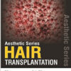 Hair Transplantation (Aesthetic) 1st Edition