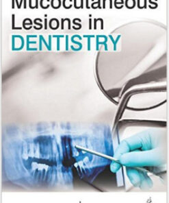 Free Mucocutaneous Lesions in Dentistry 1st Edition