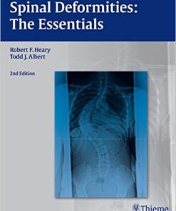 Spinal Deformities: The Essentials 2nd edition Edition by Robert F. Heary