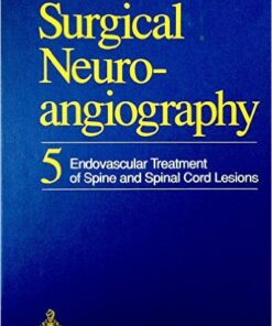 Surgical Neuroangiography: Endovascular Treatment of the Spine and Spinal Cord Lesions 1st Edition