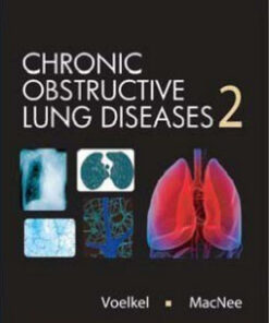 Chronic Obstructive Lung Disease 2nd Edition