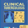 Clinical Tuberculosis, Fifth Edition 5th Edition