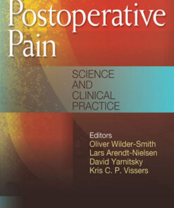 Postoperative Pain: Science and Clinical Practice 1st Edition