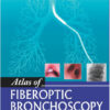 Atlas of Fiberoptic Bronchoscopy 1st Edition