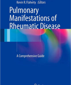 Pulmonary Manifestations of Rheumatic Disease: A Comprehensive Guide 2014th Edition