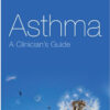 Asthma: A Clinician's Guide 1st Edition