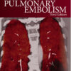 Pulmonary Embolism 3rd Edition