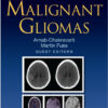 Malignant Gliomas: RMR V3 I2 (Radiation Medicine Rounds Volume 3 Issue 2) 1st Edition