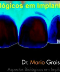 Aspectos Biologicos em Implantes Unitarios