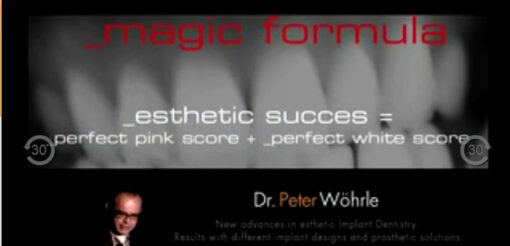 New Advances in Esthetic Implant Dentistry - Results with different Implant designs and prosthetic solutions