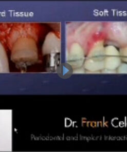 Implant Interactions in Orthodontics