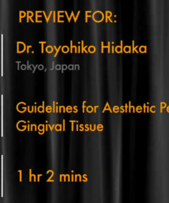 Guidelines for Aesthetic Peri-Implant Gingival Tissue (JAPANESE LANGUAGE ONLY)