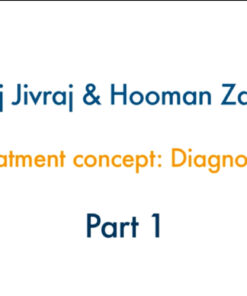 The All on 4 Concept: Diagnosis to Delivery Part 1 - Diagnosis and Treatment Planning, Concepts of Immediate Loading