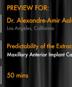 Predictability of the Extraction Site Implant Part 2: Maxillary Anterior Implant Case Protocol