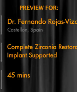 Complete Zirconia Restorations - Implant Supported