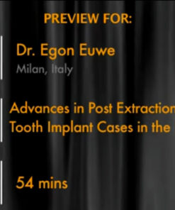 Advances in Post Extraction Single Tooth Implant Cases in the Esthetic Zone