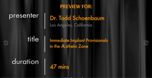 Immediate Implant Provisionals in the Aesthetic Zone