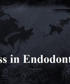 Video Access in Endodontics - Ivan Vyuchnov