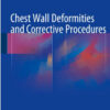 Chest Wall Deformities and Corrective Procedures 1st ed. 2016 Edition