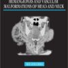 The Management of Hemangiomas and Vascular Malformations of Head and Neck