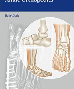 Handbook of Foot and Ankle Orthopedics 1st Edition