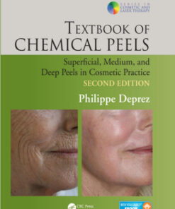 Textbook of Chemical Peels, Second Edition: Superficial, Medium, and Deep Peels in Cosmetic Practice (Series in Cosmetic and Laser Therapy) 2nd Edition