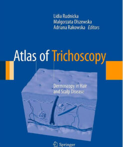 Atlas of Trichoscopy: Dermoscopy in Hair and Scalp Disease 1st ed. 2012 Edition