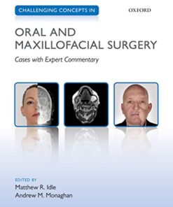 Challenging Concepts in Oral and Maxillofacial Surgery: Cases with Expert Commentary