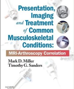 Presentation, Imaging and Treatment of Common Musculoskeletal Conditions: MRI-Arthroscopy Correlation