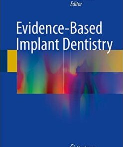 Evidence-Based Implant Dentistry 1 Edition 2016