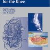 Surgical Techniques for the Knee