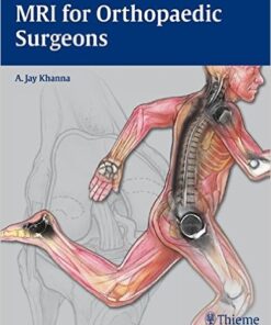 MRI for Orthopaedic Surgeons 1st Edition