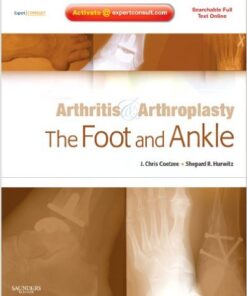 Arthritis and Arthroplasty: The Foot and Ankle: Expert Consult  1e