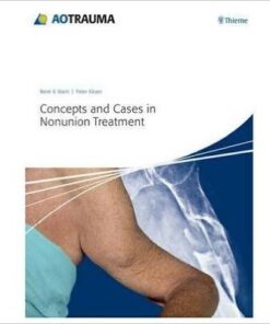 Concepts and Cases in Nonunion Treatment