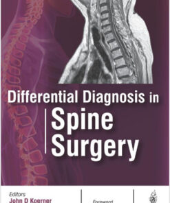 Differential Diagnosis in Spine Surgery 1st Edition