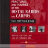 Fractures and Injuries of the Distal Radius and Carpus: The Cutting Edge 1e