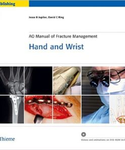 Hand and Wrist: AO Manual of Fracture Management 1st Edition